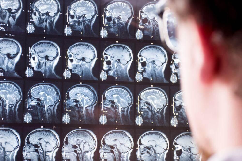 Man examining MRI brain images for traumatic