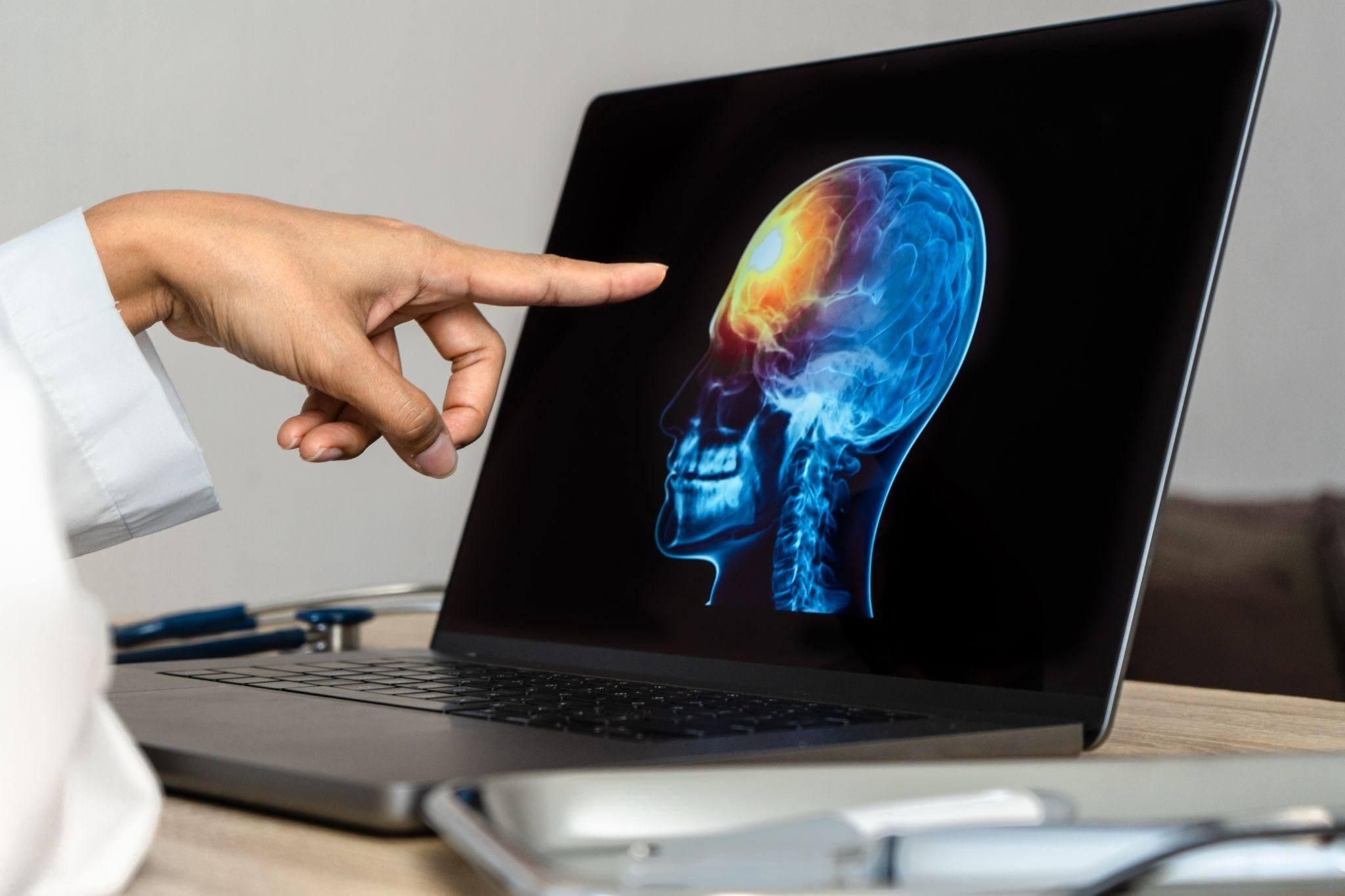 Person pointing at computer screen displaying a skeleton, related
